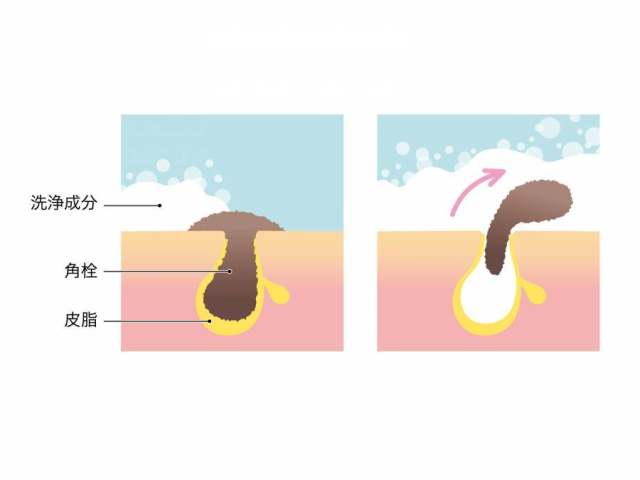 皮肤的剖面图_清洁毛孔