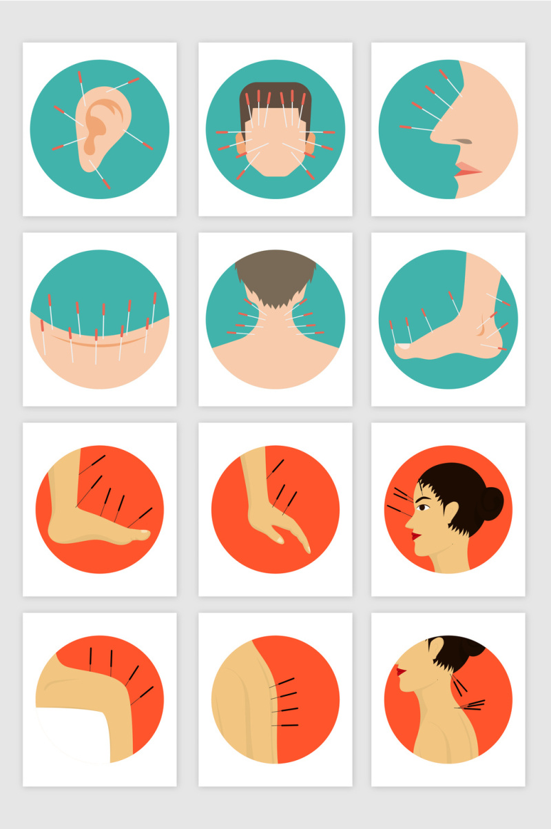 矢量卡通中医针灸