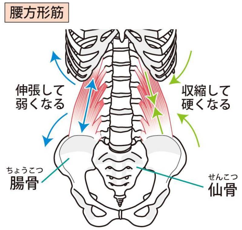 腰方形筋