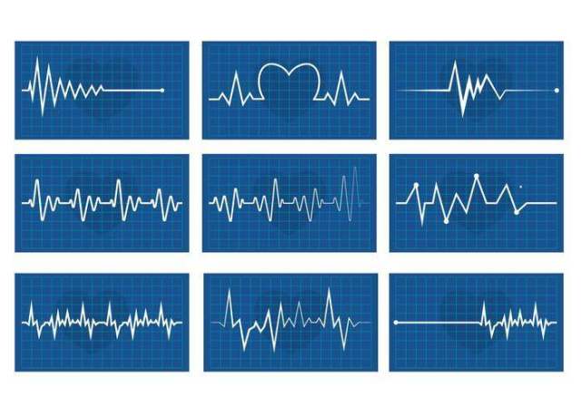 心脏节奏矢量包