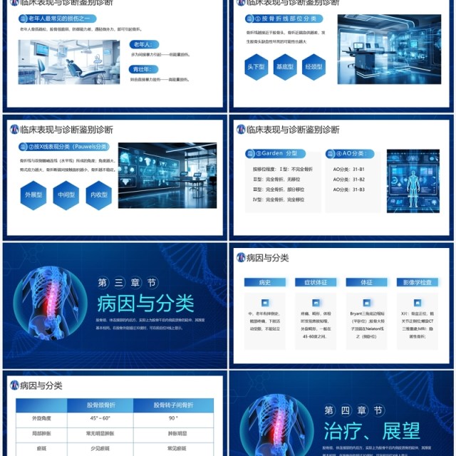 蓝色医疗风股骨颈骨折课件PPT模板