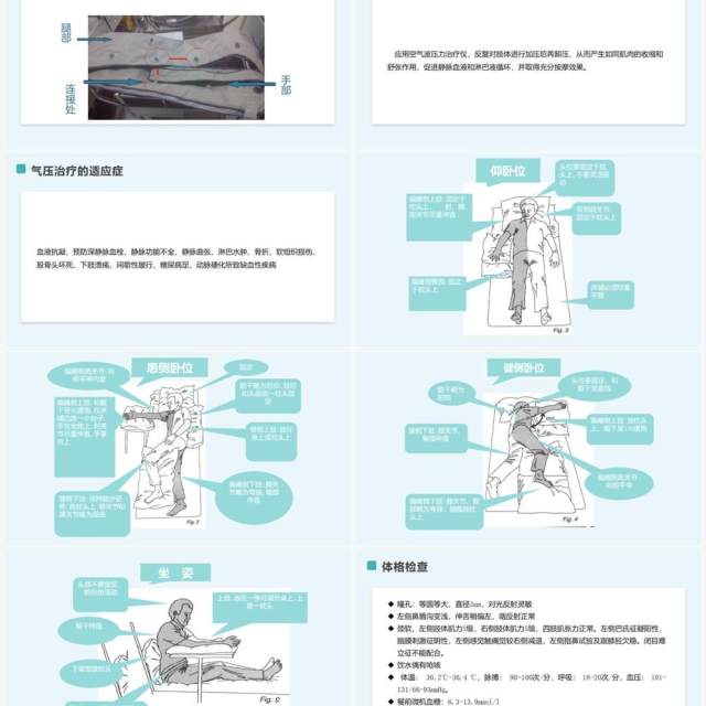 绿色简约脑梗塞护理查房PPT模板