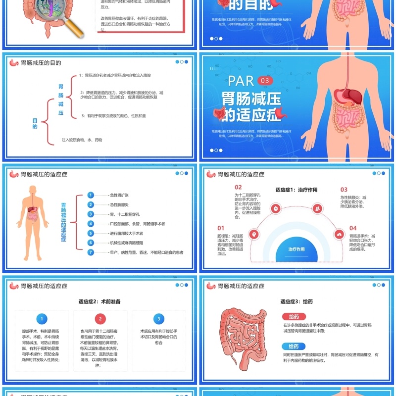 蓝色卡通风胃肠减压的护理PPT模板