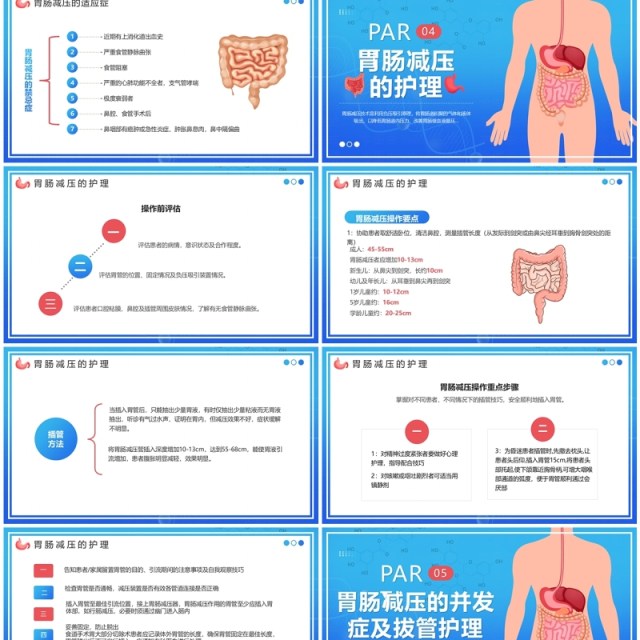 蓝色卡通风胃肠减压的护理PPT模板