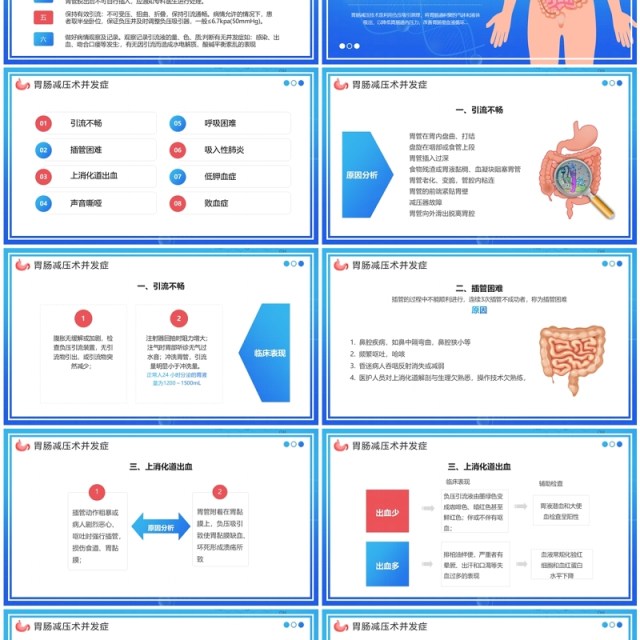 蓝色卡通风胃肠减压的护理PPT模板