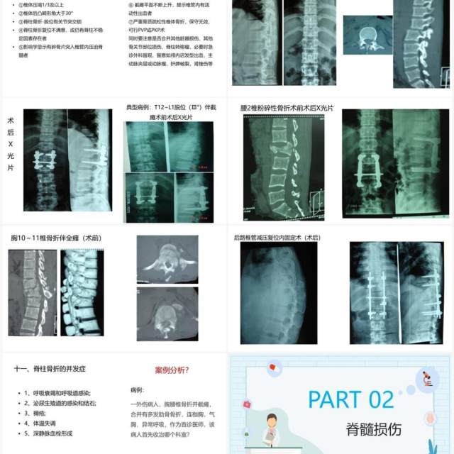 蓝色卡通风脊柱骨折与脊髓损伤PPT模板