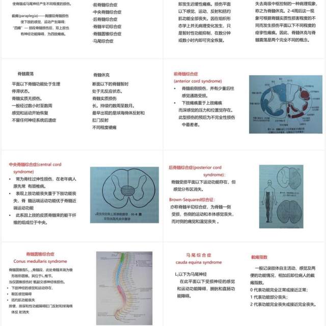 蓝色卡通风脊柱骨折与脊髓损伤PPT模板 蓝色卡通风脊柱骨折与脊髓损伤PPT模板