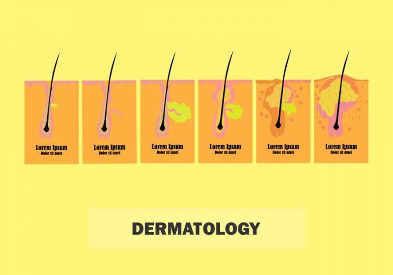 任何目的的皮肤皮肤科