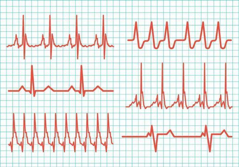心脏节奏矢量图标