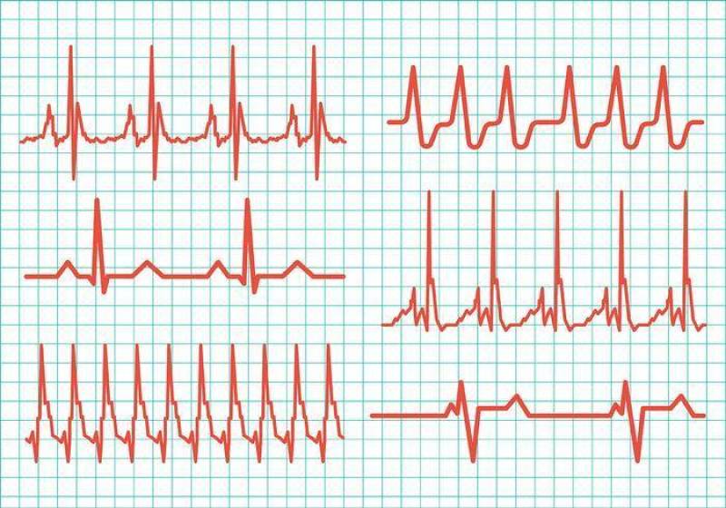 心脏节奏矢量图标