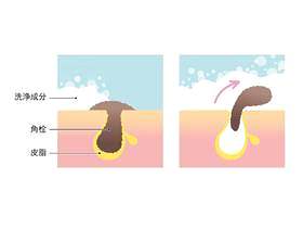 皮肤的剖面图_清洁毛孔