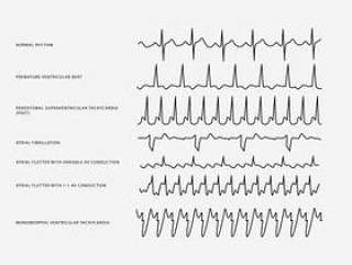 心脏节奏集合矢量