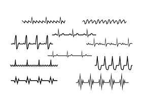  的心脏节奏集合矢量