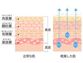 皮肤　断面図