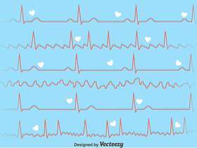 在蓝色背景的心脏节奏