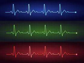 心脏脉冲心电图矢量