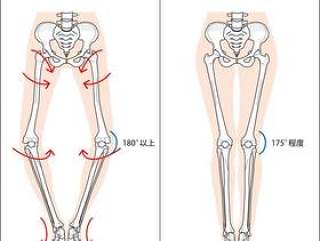 膝关节的排列异常