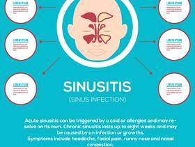 鼻窦炎信息图表插图
