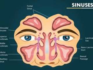 鼻窦矢量设计