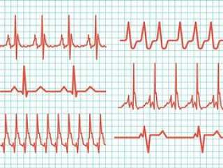心脏节奏矢量图标