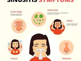 鼻窦炎矢量卡通信息图表