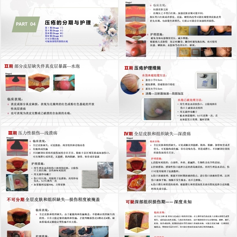 压疮的预防及护理医院用PPT模板