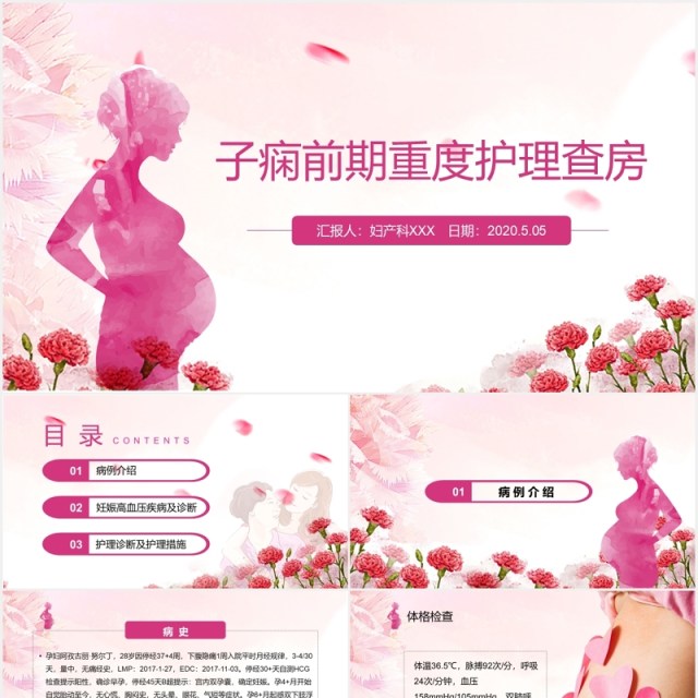 粉色女性妇科子痫前期重度护理查房课件PPT模板 粉色女性妇科子痫前期重度护理查房课件PPT模板
