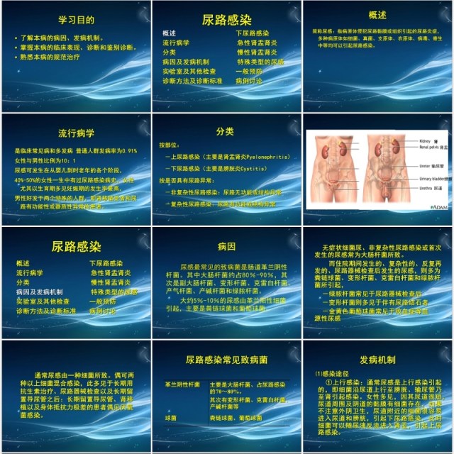 简约泌尿系尿路感染护理查房PPT模板