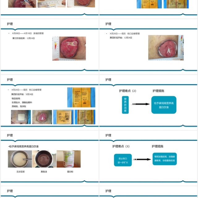 胶质瘤术后病人压疮护理PPT模板