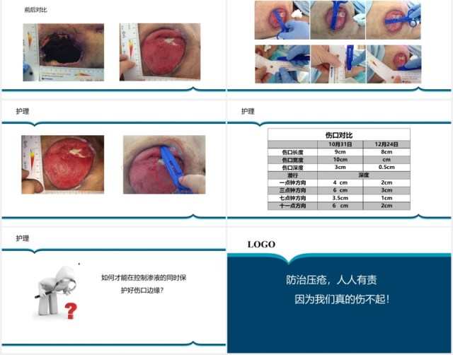 胶质瘤术后病人压疮护理PPT模板