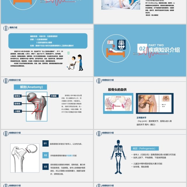 卡通简约风医学股骨颈骨折护理查房PPT模板