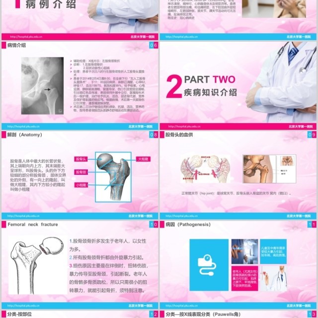 简洁医院医疗股骨颈骨折护理查房PPT模板 简洁医院医疗股骨颈骨折护理查房PPT模板