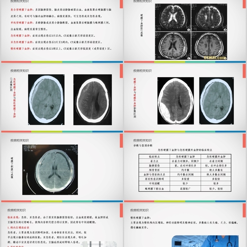 亚急性硬膜下血肿护理查房PPT模板