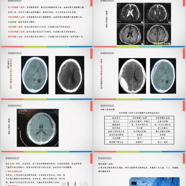 亚急性硬膜下血肿护理查房PPT模板 亚急性硬膜下血肿护理查房PPT模板