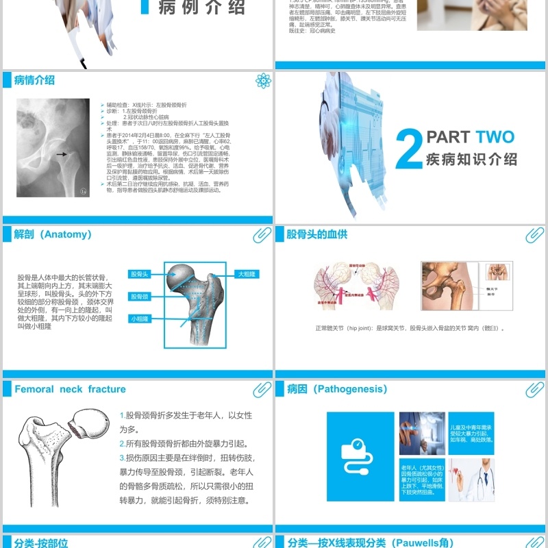 蓝色课件股骨颈骨折护理查房PPT模板